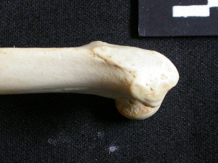 Femur: proximale part