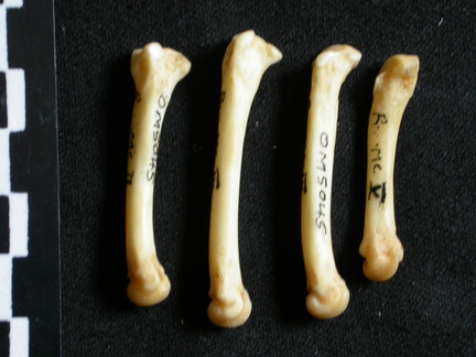 Metacarpals