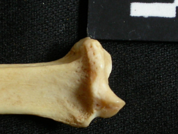 Radio : parte distal