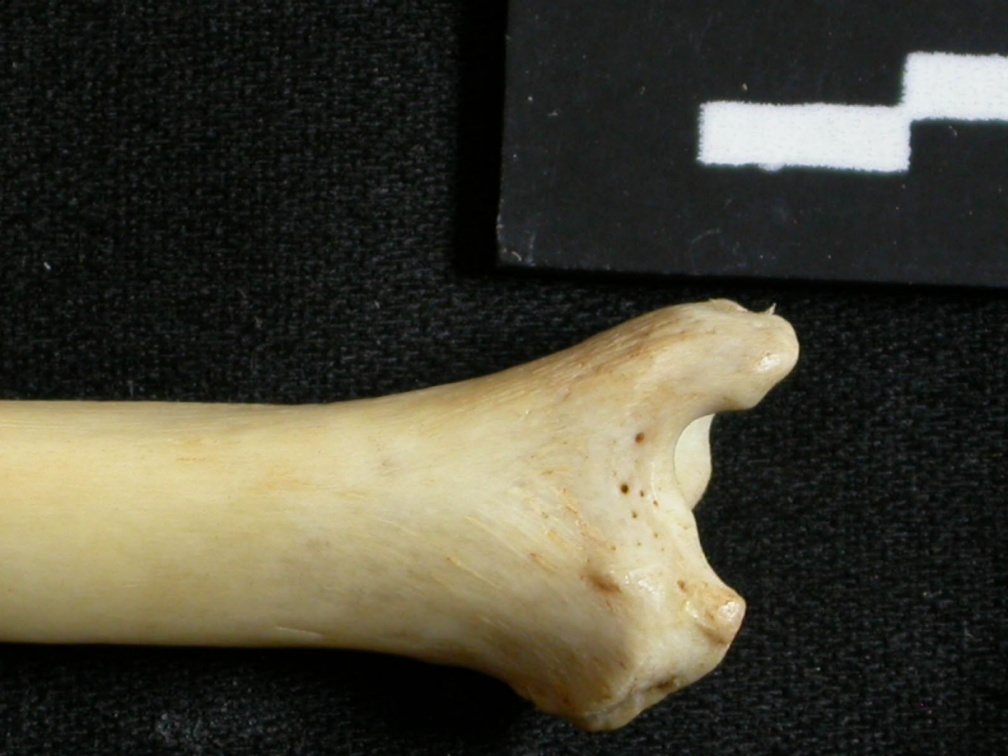 Tibia : partie distale