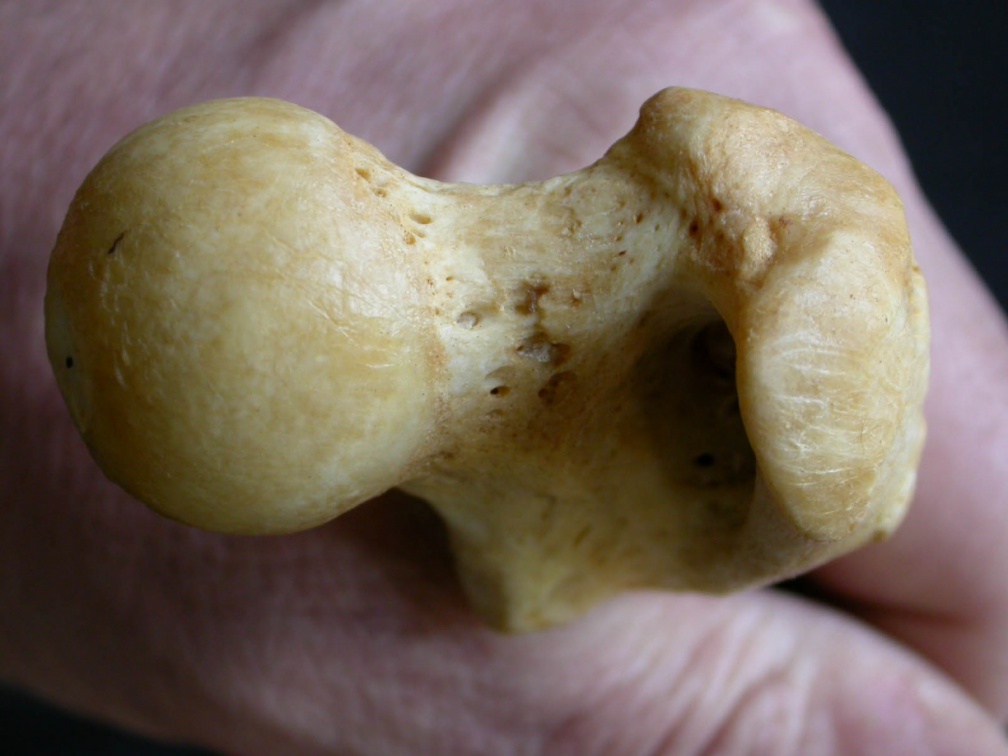 Fémur : partie proximale