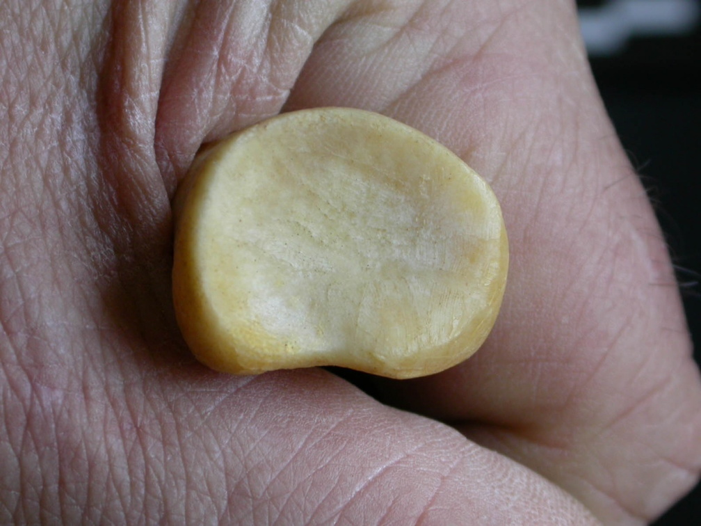 Radio : parte proximal