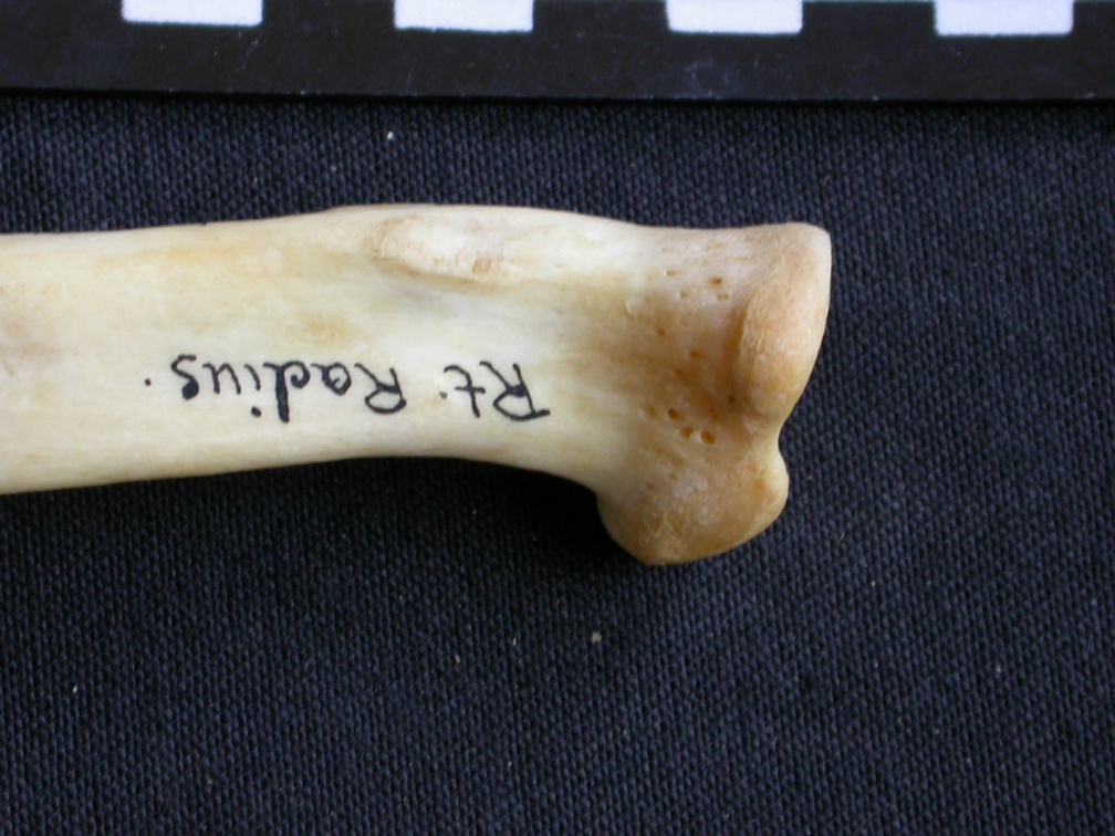 Radio : parte proximal