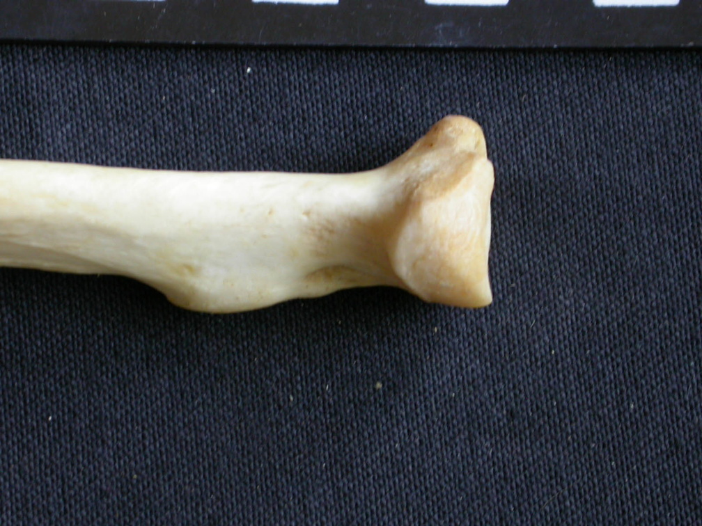 Radio : parte proximal