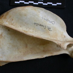 Scapula : vue latérale