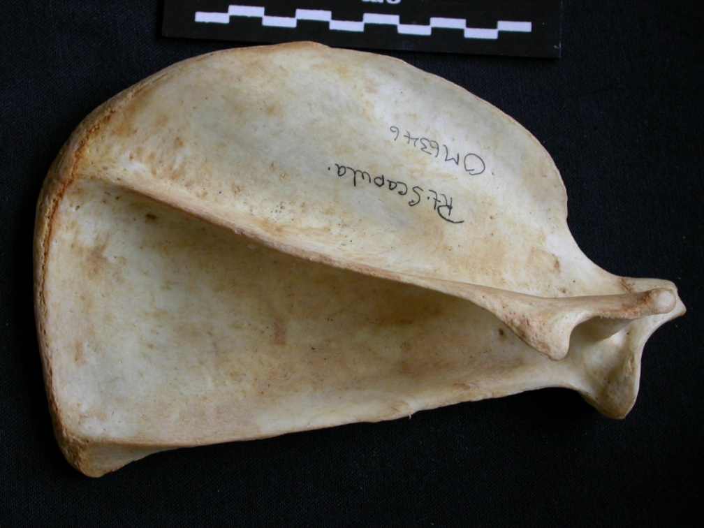 Scapula : vue latérale
