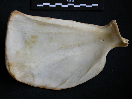 Scapula : vue médiale