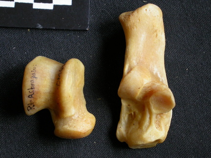 Talus and calcaneus