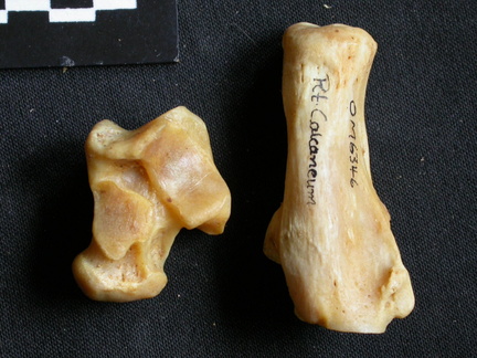 Talus and calcaneus