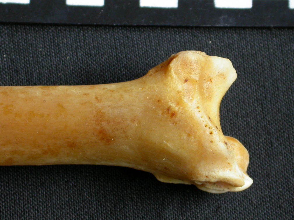 Tibia : parte distal