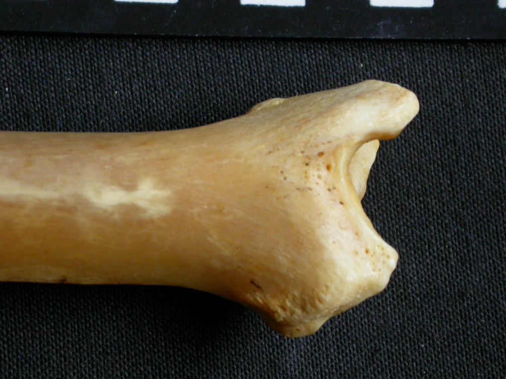 Tibia : parte distal