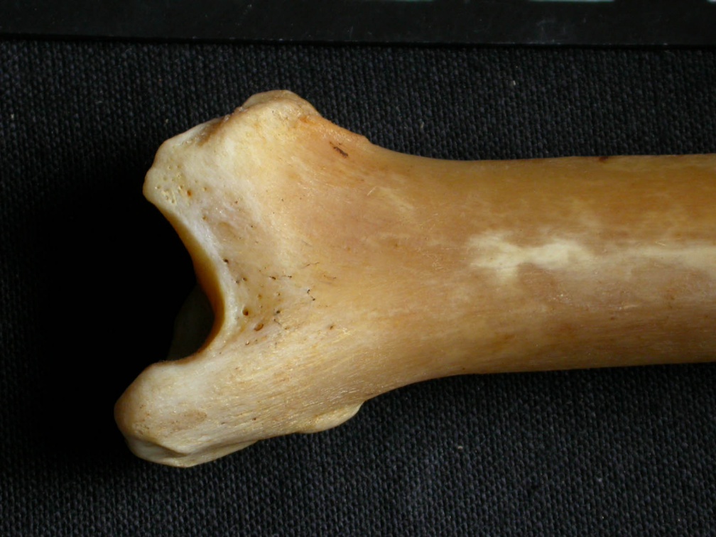 Tibia : parte distal