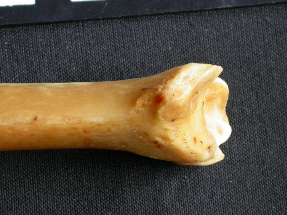 Tibia : parte distal