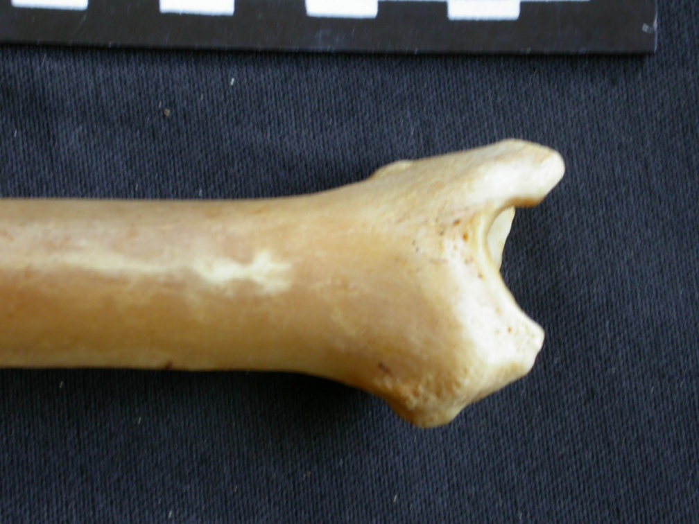 Tibia : parte distal