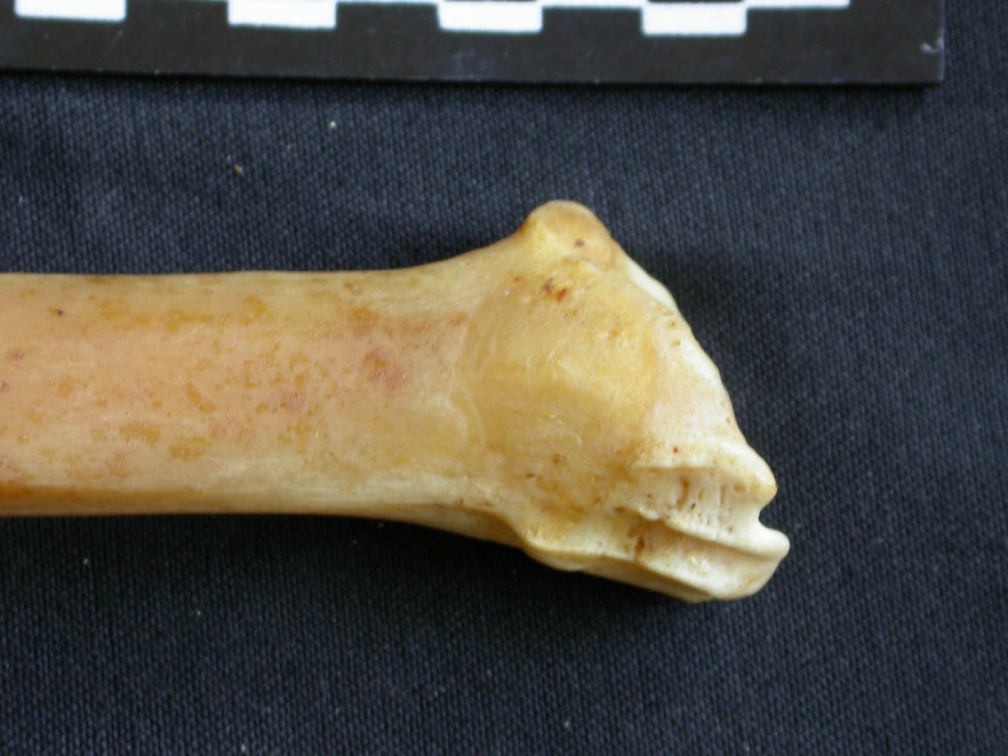 Tibia : parte distal