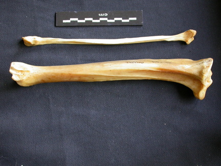 Tibia et fibula