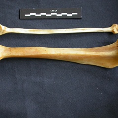 Tibia et fibula