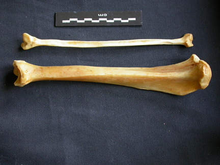 Tibia et fibula