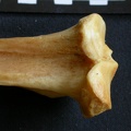  Tibia: proximale part