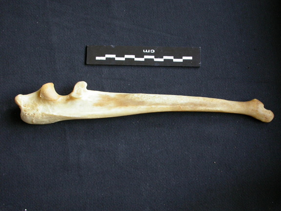 Ulna