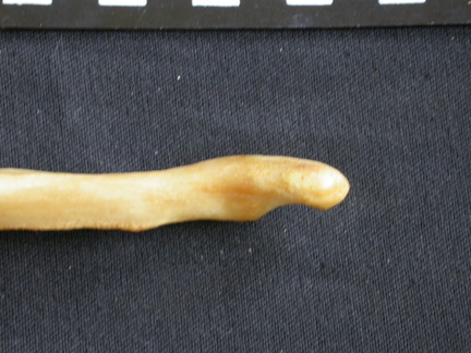  Ulna: distal part