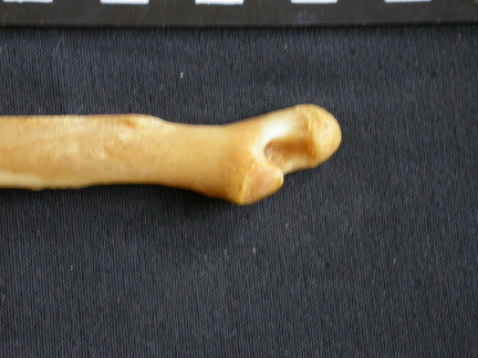  Ulna: distal part