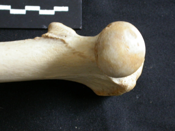 Fémur : partie proximale