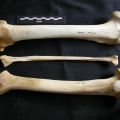 Fémur, tibia et fibula