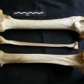 Fémur, tibia et fibula