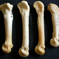 Metacarpals