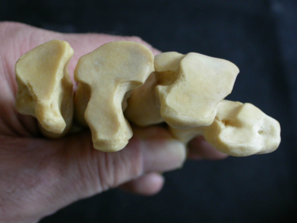 Metatarsals: proximale part