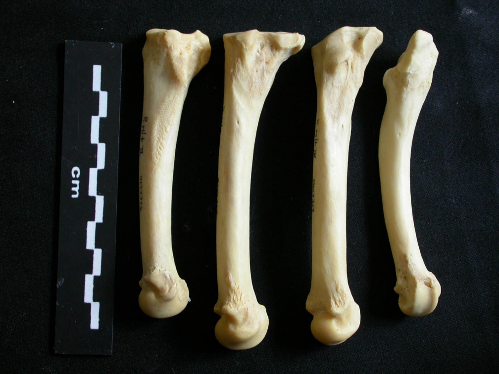 Metatarsals