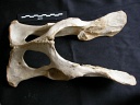 Pelvis