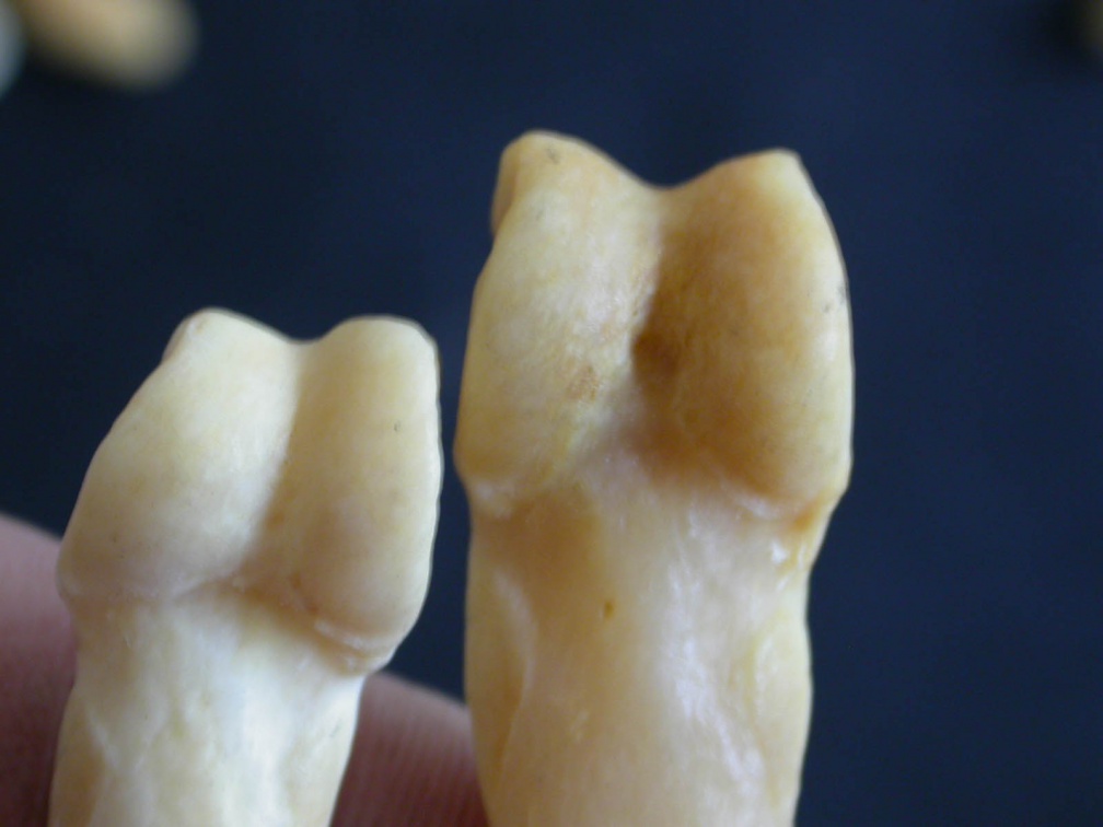 Phalanges: distal part