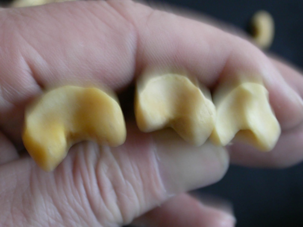 Phalanges: proximale part