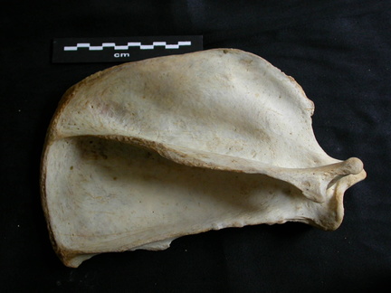 Scapula: side view