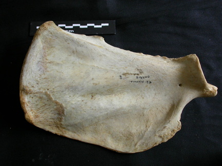 Scapula: medial view