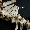 Thoracic vertebrae