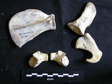  Scapula and coxal