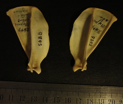 Scapulas : vue latérale