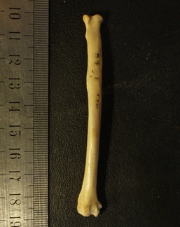 Radius : vue antérieure