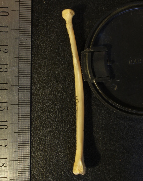 Radius : vue latérale