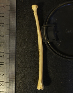 Radius : vue latérale