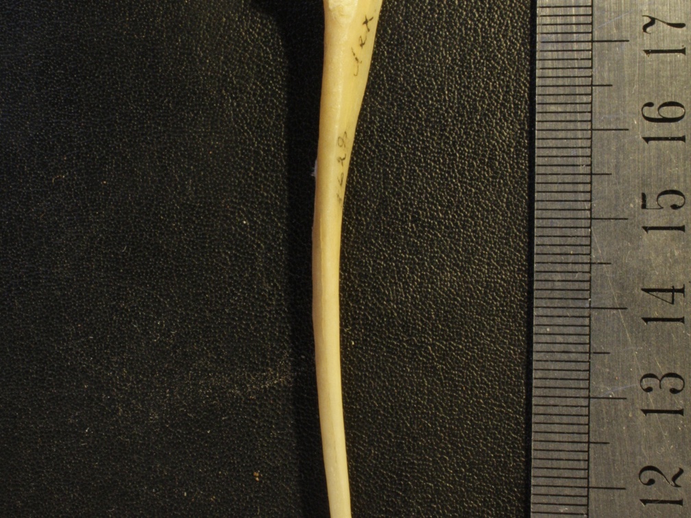 Ulna : vista medial