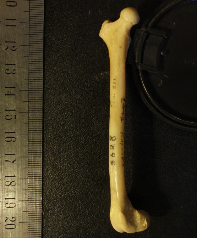 Fémur : vue médiale