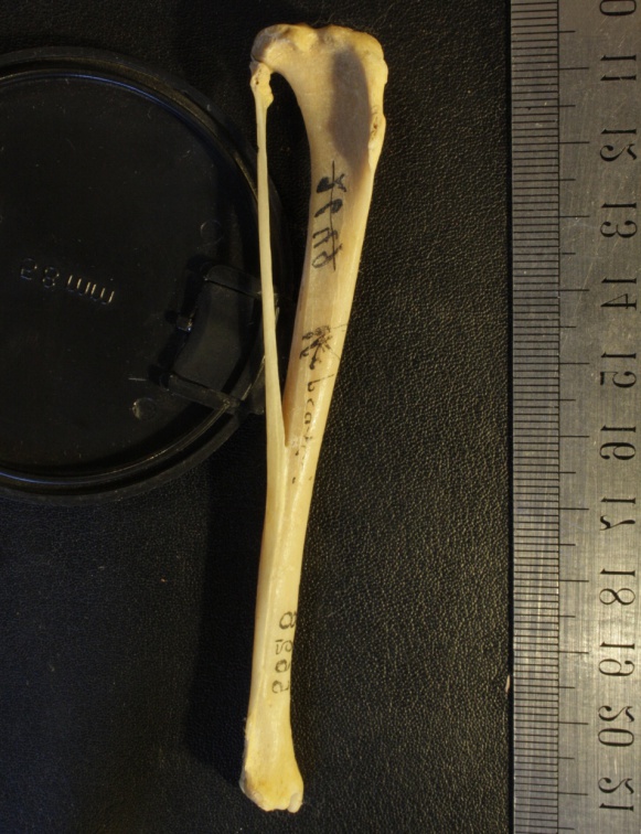 Tibia et fibula : vue latérale