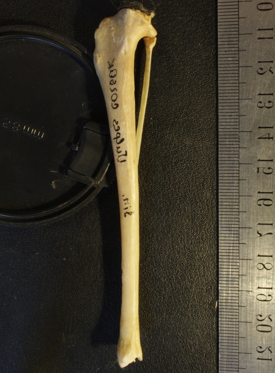 Tibia et fibula : vue médiale