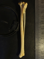 Tibia et fibula : vue postérieure