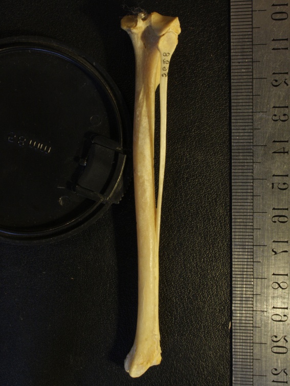 Tibia et fibula : vue postérieure