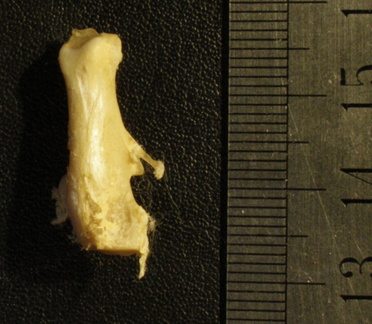 Calcaneus: posterior view